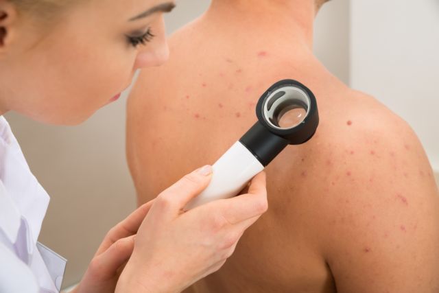 C-Derm Kρέμα Mουρουνέλαιου 50% – Αποτελεσματική και Ασφαλής στην Ψωρίαση κατά Πλάκας C-Derm Kρέμα Mουρουνέλαιου 50% - Αποτελεσματική και Ασφαλής στην Ψωρίαση κατά Πλάκας