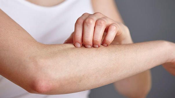 Εφικτή η Πλήρης Δερματική Κάθαρση για τους Ασθενείς με Ψωρίαση M Εφικτή η Πλήρης Δερματική Κάθαρση για τους Ασθενείς με Ψωρίαση M