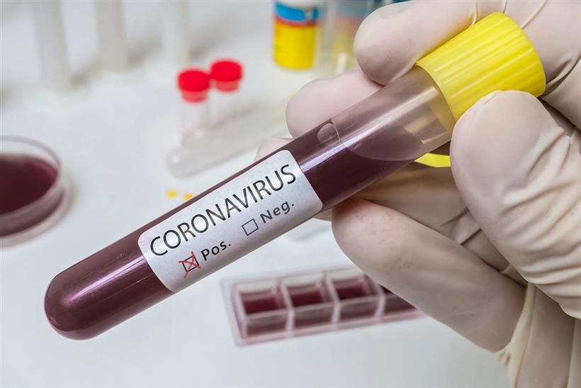 Κορωνοϊός - Μαζικός Έλεγχος και Απομόνωση Μολυσμένων Ατόμων.