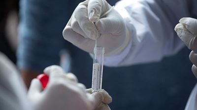 Η Έκφραση του ACE2 στο Ρινικό Επιθήλιο των Παιδιών και η Ευπάθεια στον Κορωνοϊό.