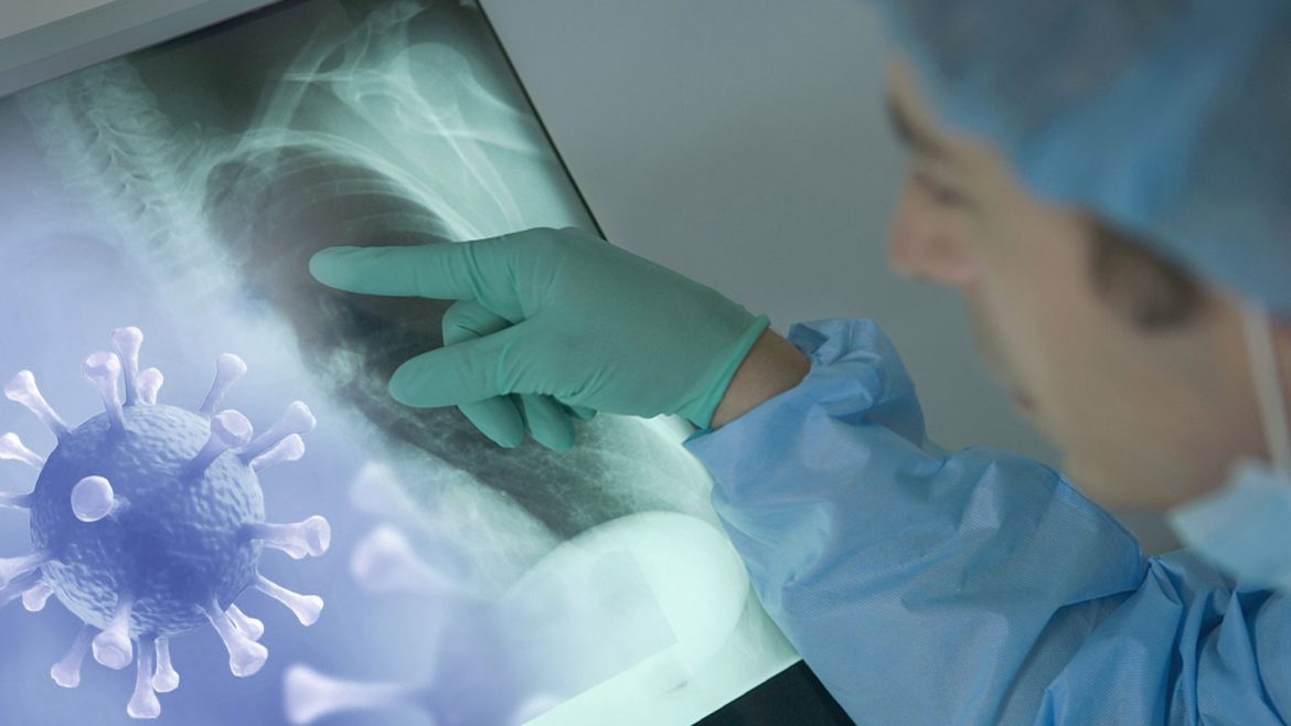 Μερικούς Άτυχους ο Κορωνοϊός Μπορεί να τους Ταλαιπωρήσει για Μήνες.