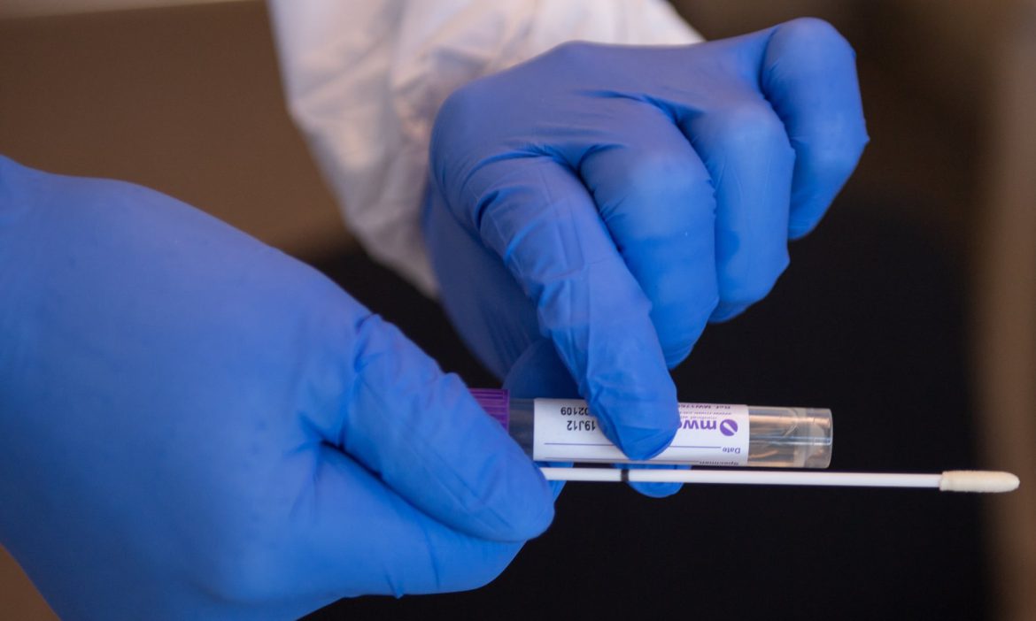 Κορωνοϊός - Πόσο Αξιόπιστα Είναι τα Τεστ Αντισωμάτων;