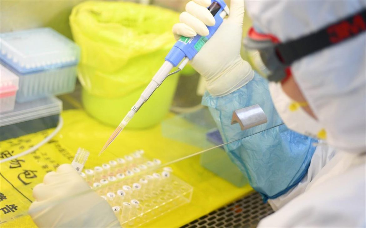 Ισχυρά Αντισώματα Έναντι του SARS-CoV-2 Ανευρίσκονται σε Ασθενείς που Ανέρρωσαν από την COVID-19 και Βοηθούν στην Ανάπτυξη Εμβολίων.