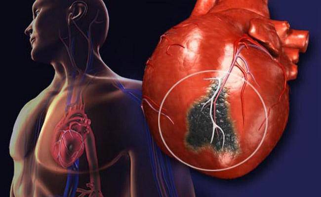 Η Διαχείριση Ασθενών με Οξύ Έμφραγμα του Μυοκαρδίου με Ανάσπαση του ST Διαστήματος στην Εποχή της COVID-19.