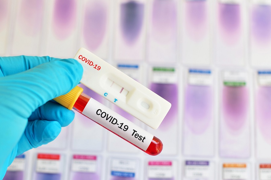 Δυνατότητες και Περιορισμοί των Rapid Test για COVID-19. Δυνατότητες και Περιορισμοί των Rapid Test για COVID-19.