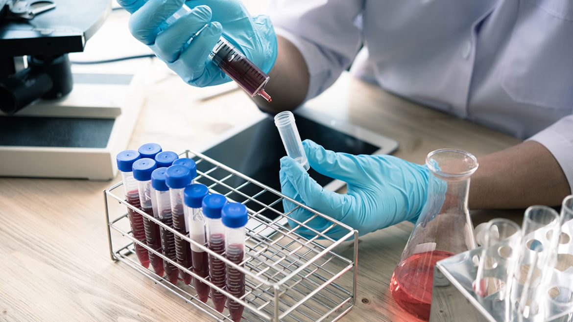 COVID-19: Η Αποτελεσματικότητα της Θεραπείας με Πλάσμα Αίματος από Αναρρώσαντες. COVID-19: Η Αποτελεσματικότητα της Θεραπείας με Πλάσμα Αίματος από Αναρρώσαντες.