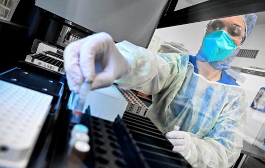 Νέα Κλινική Μελέτη Συνδυάζει το Αντι-ιϊκό Φάρμακο Remdesivir με Ένα «Συμπυκνωμένο» Διάλυμα Αντισωμάτων που Εξουδετερώνουν τον SARS-CoV-2. Νέα Κλινική Μελέτη Συνδυάζει το Αντι-ιϊκό Φάρμακο Remdesivir με Ένα «Συμπυκνωμένο» Διάλυμα Αντισωμάτων που Εξουδετερώνουν τον SARS-CoV-2.