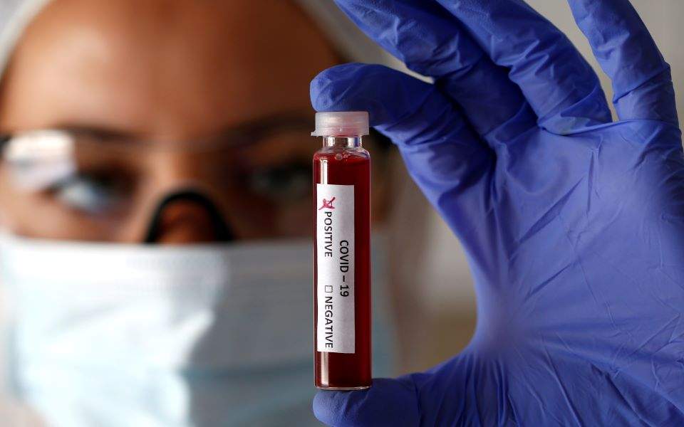 Μικρότερη Πιθανότητα Μόλυνσης από Κορωνοϊό Έχουν τα Άτομα με Ομάδα Αίματος 0 Μικρότερη Πιθανότητα Μόλυνσης από Κορωνοϊό Έχουν τα Άτομα με Ομάδα Αίματος 0