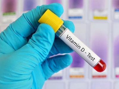 Έχει η Βιταμίνη D Φαρμακολογικές Επιδράσεις έναντι της Covid-19;