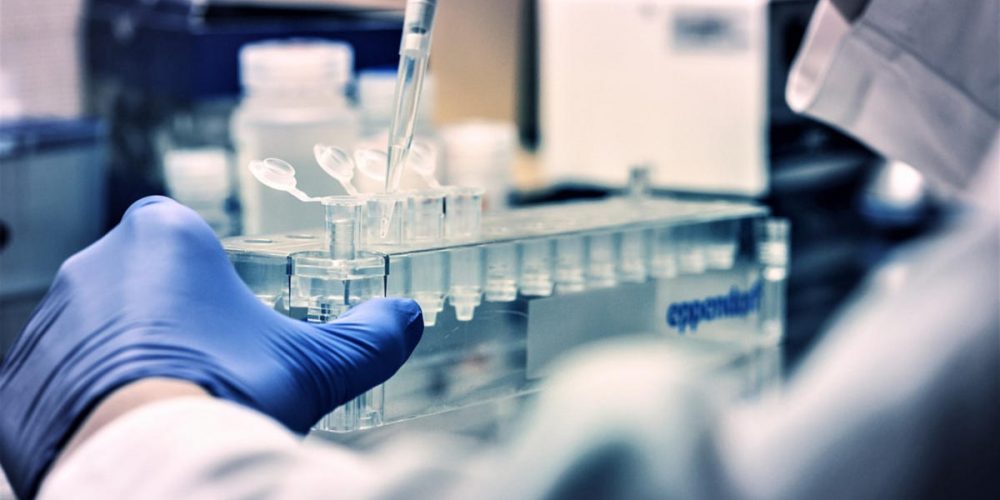 Το Εμβόλιο mRNA-1273 της Εταιρείας Moderna Έχει 94% Αποτελεσματικότητα – Αποτελέσματα της Τυχαιοποιημένης Μελέτης Φάσης 3 COVE. Το Εμβόλιο mRNA-1273 της Εταιρείας Moderna Έχει 94% Αποτελεσματικότητα - Αποτελέσματα της Τυχαιοποιημένης Μελέτης Φάσης 3 COVE.
