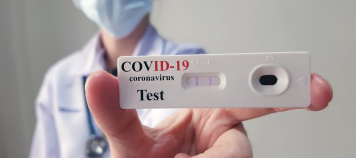 Αξιολόγηση της Χρήσης των Rapid Test για τη Λοίμωξη SARS-CoV-2.