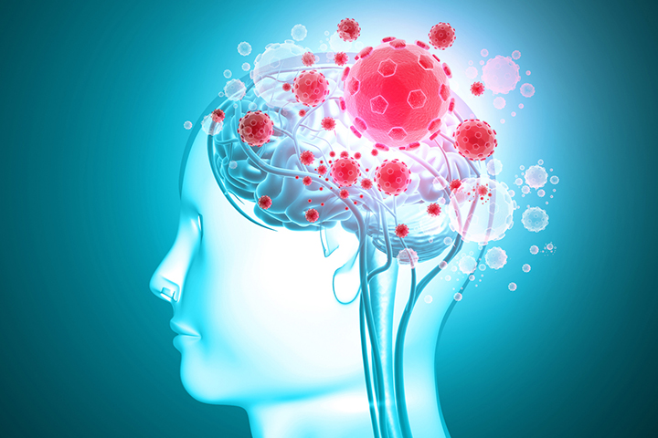 Η Παγκόσμια Επίπτωση της Πανδημίας COVID-19 στην Οξεία Αντιμετώπιση του Αγγειακού Εγκεφαλικού Επεισοδίου.