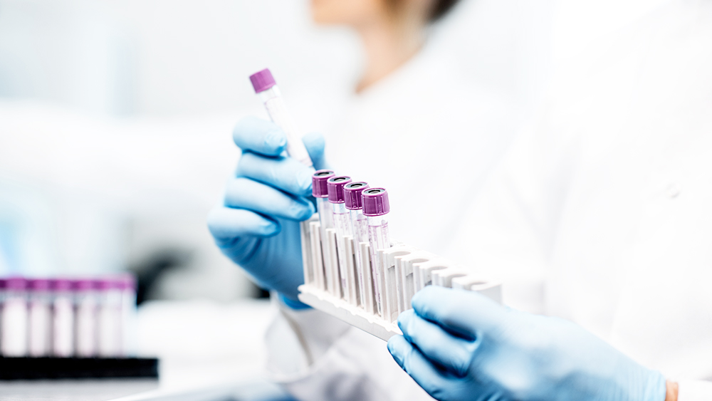 Η Λάθος Αξιολόγηση των Τεστ Αντισωμάτων Μπορεί να Οδηγήσει στη μη Σωστή Εκτίμηση της Ανοσίας Έναντι του SARS-CoV-2.