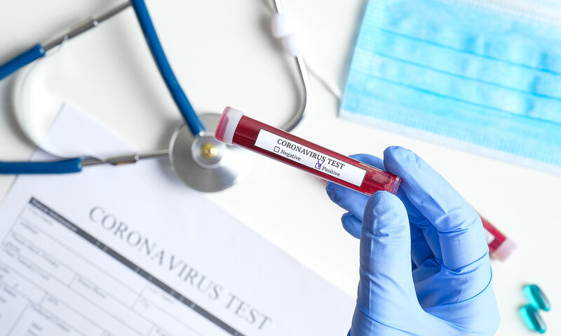 Έξαρση των Κρουσμάτων της Covid-19 στην Ανατολική Ευρώπη.