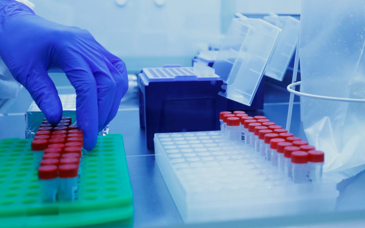 Σχεδόν Όλα τα Μονοκλωνικά Αντισώματα Φαίνονται Αναποτελεσματικά Κατά της Όμικρον.