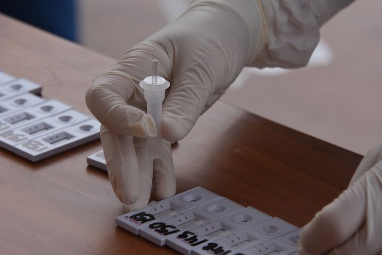 Εκτίμηση των Ψευδώς Θετικών Αποτελεσμάτων στα Αντιγονικά Rapid Test για τον SARS-CoV-2.