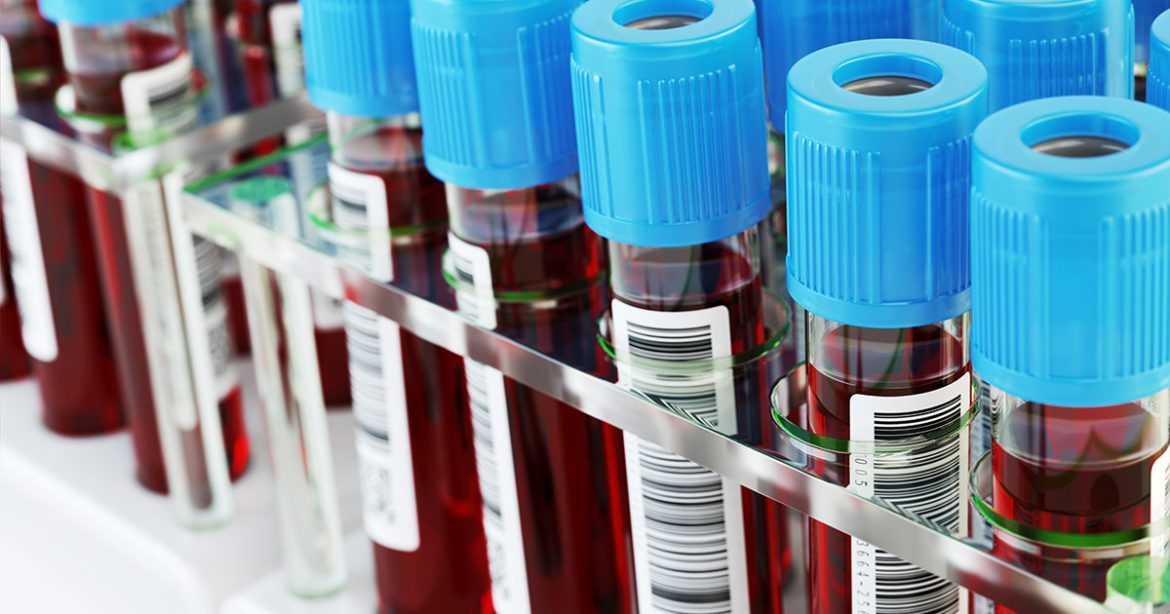 Εξέταση Αίματος Ικανή να Ανιχνεύσει Έγκαιρα Περισσότερες από 50 Μορφές Καρκίνου.