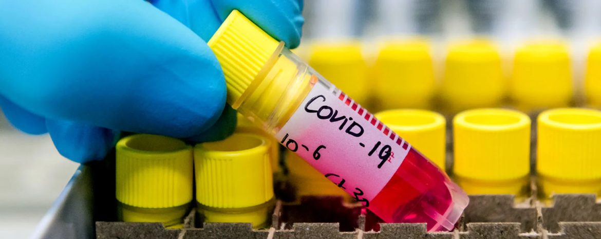 3 χρόνια μετά την πανδημία ο COVID διατηρεί την ίδια κλινική εικόνα αλλά οι έρευνες για τον εντοπισμό της παθοφυσιολογίας και των κατάλληλων θεραπειών προχωρά