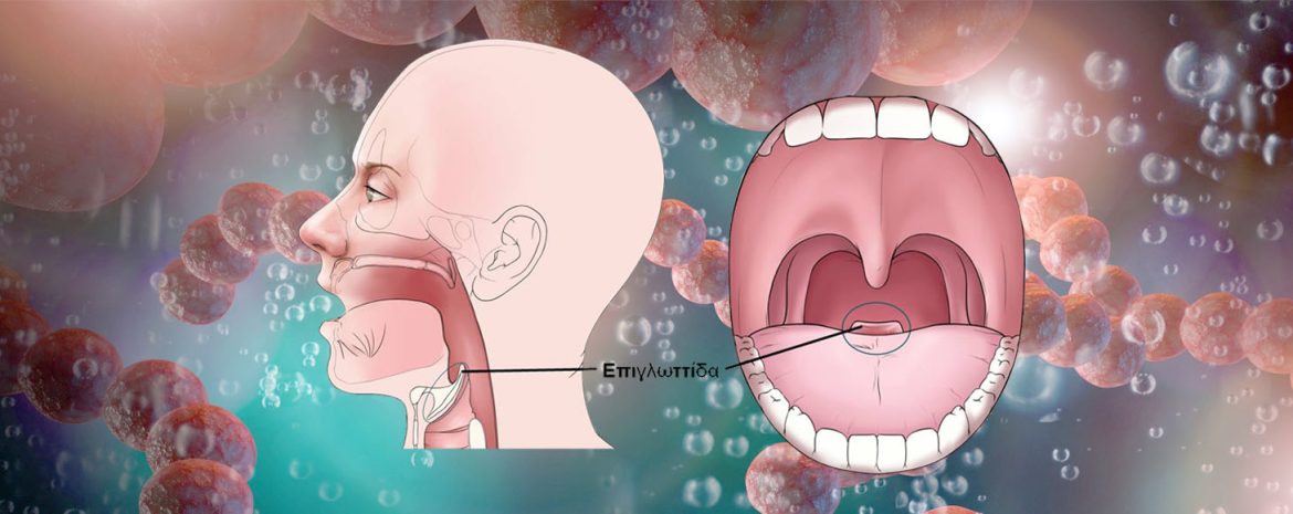 Η στρεπτοκοκκική φαρυγγοαμυγδαλίτιδα προκαλείται από τον πυογόνο στρεπτόκοκκο (Streptococcus pyogenes) κατατασσόμενη στα σοβαρά παθογόνα από ένζυμα και τοξίνες