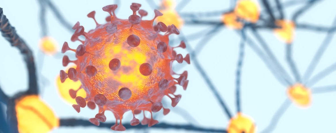 Η νόσηση με λοίμωξη Covid-19 μπορεί να οδηγήσει στην ανάπτυξη τσυνδρόμου Γκιλαίνε-Μπαρέ