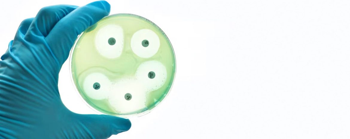 Ο ΠΟΥ ανησυχεί για την αυξημένη αντιμικροβιακή αντίσταση