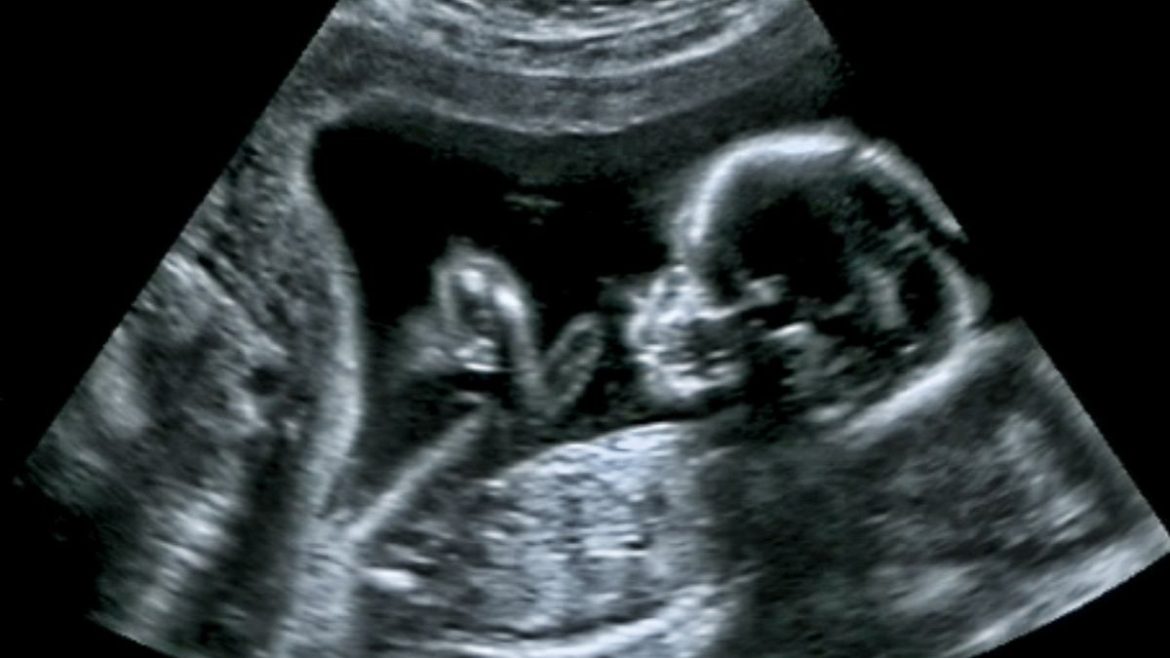 Θεραπεία ενδομητρίως