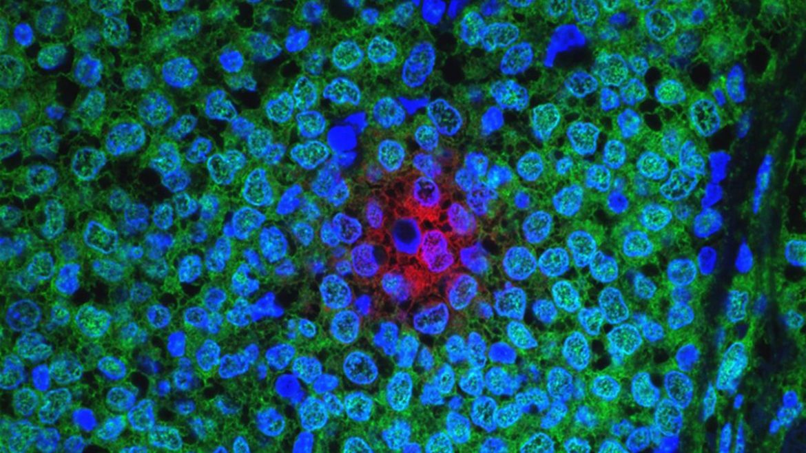 Εμμηνόπαυση